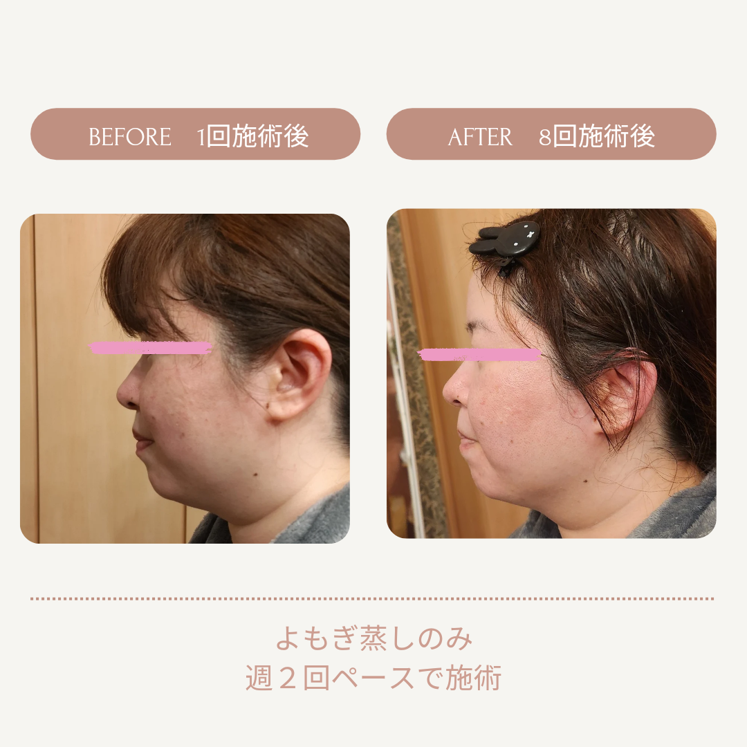 よもぎ 蒸し 効果